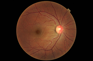 image of a retina
